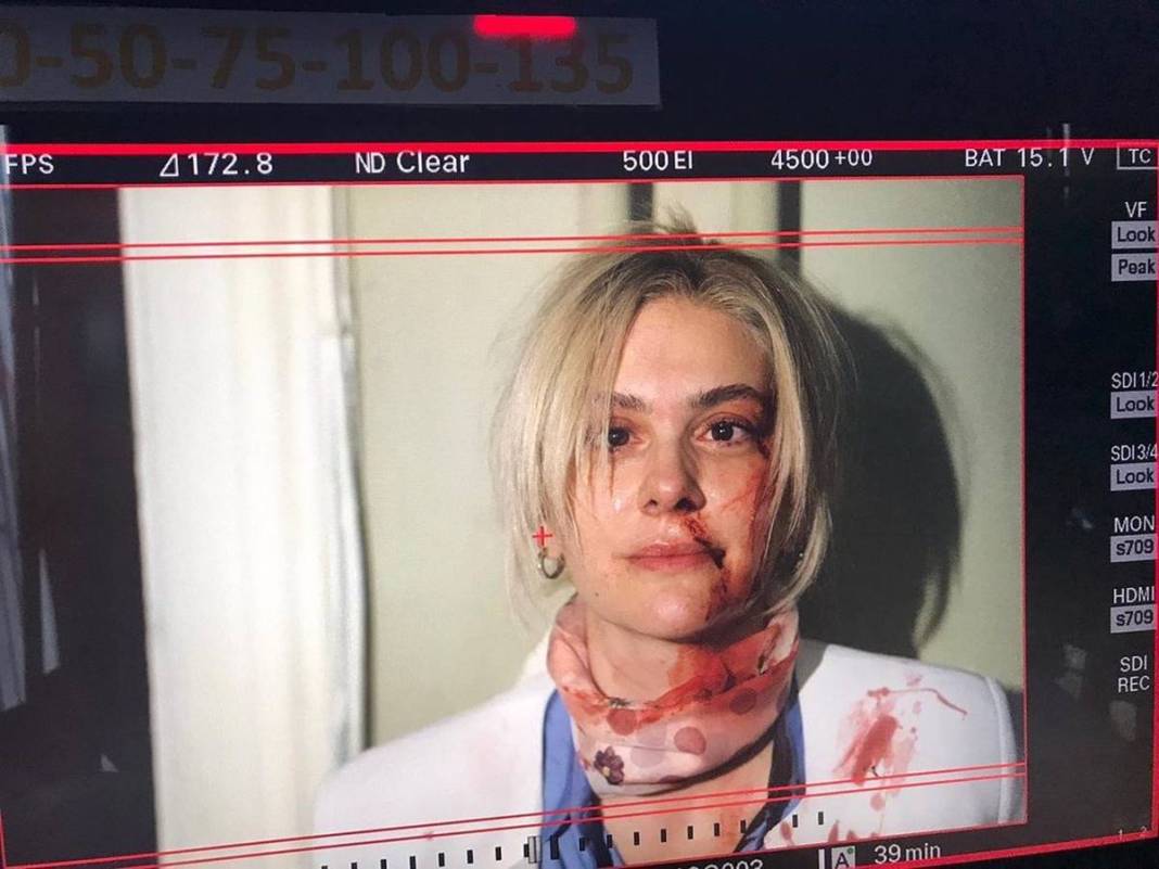 Bergüzar Korel'in kanlı paylaşımı takipçilerini korkuttu! Neden paylaştığı daha sonra ortaya çıktı 1